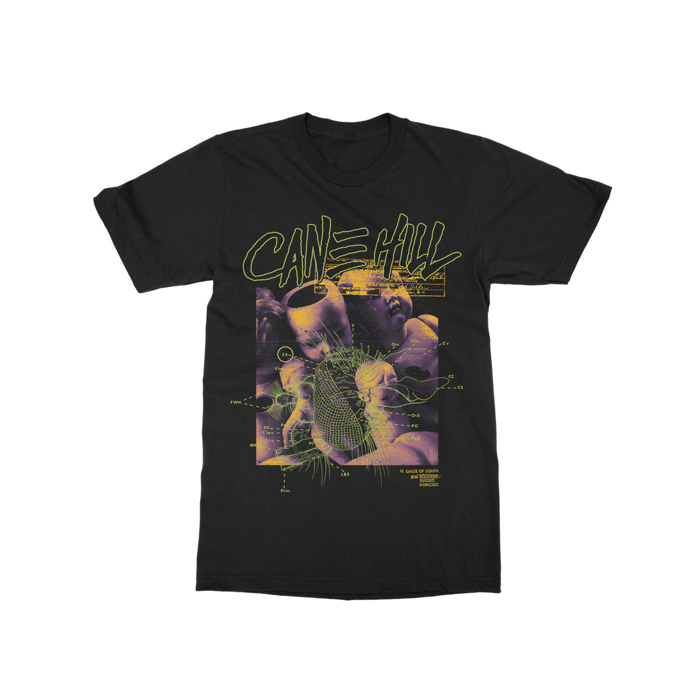 Cause Of Death Black T-Shirt